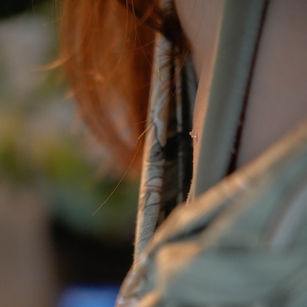 TagBand® | Tecnologia Dermatológica em Casa